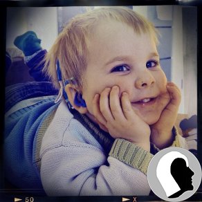 CI Kopf 2018 männlich Kind